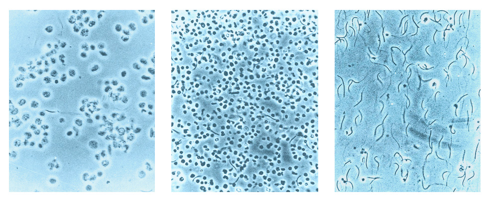 Nuclei elutriation